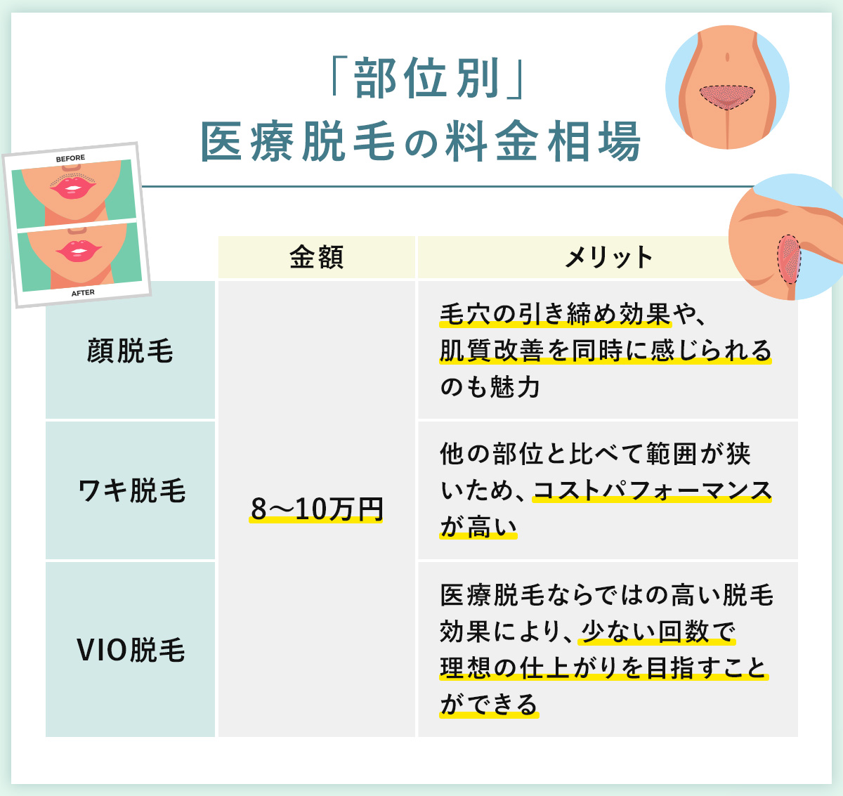 02_「部位別」医療脱毛の料金相場