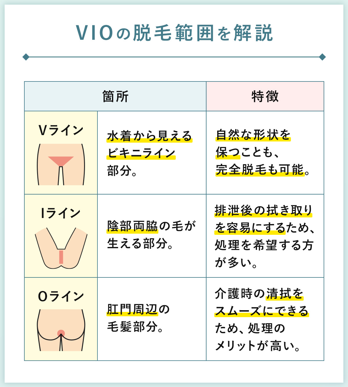 06_VIOの脱毛範囲を解説