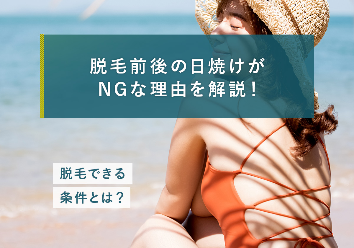 74_脱毛_日焼け