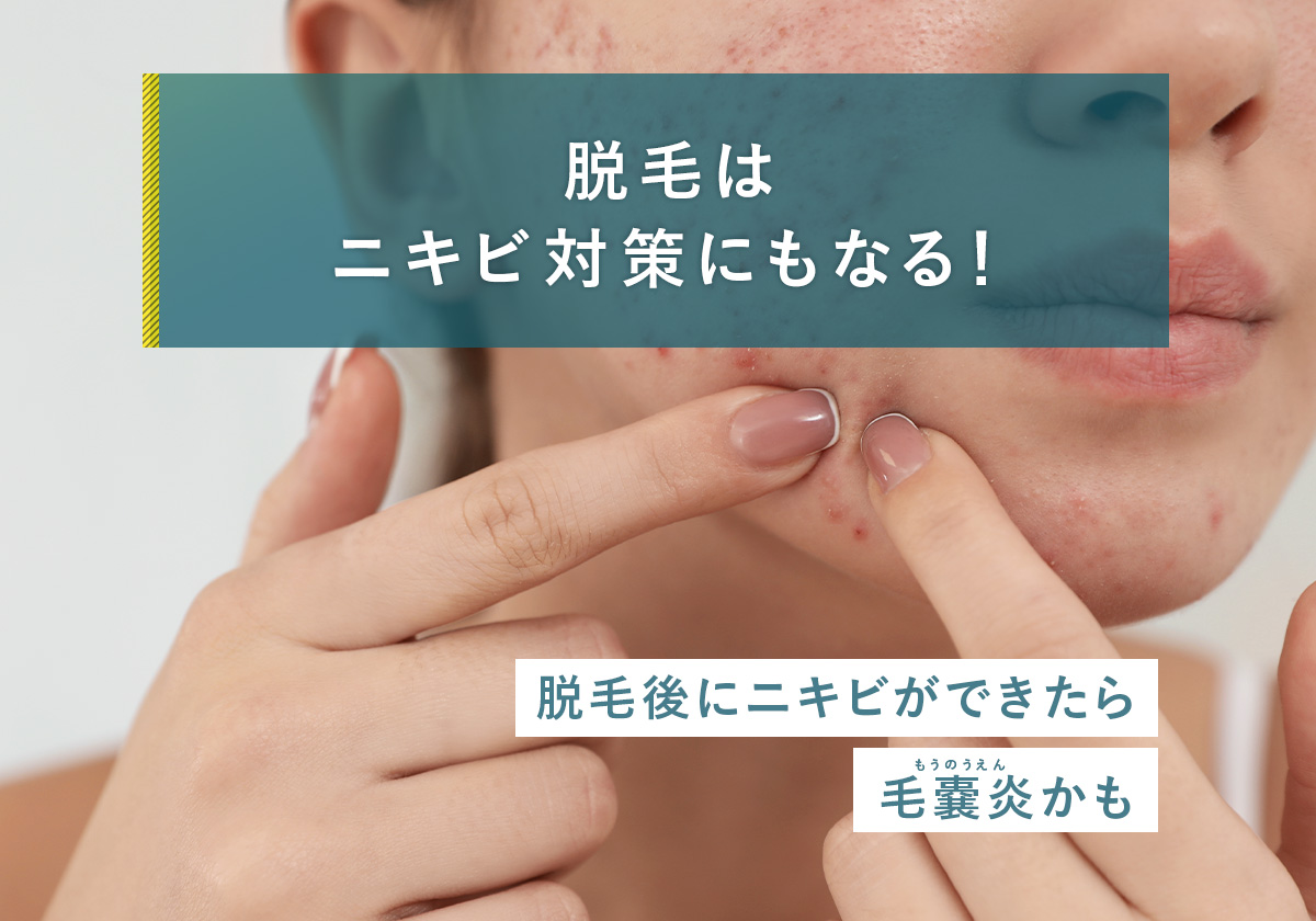 76_脱毛_ニキビ