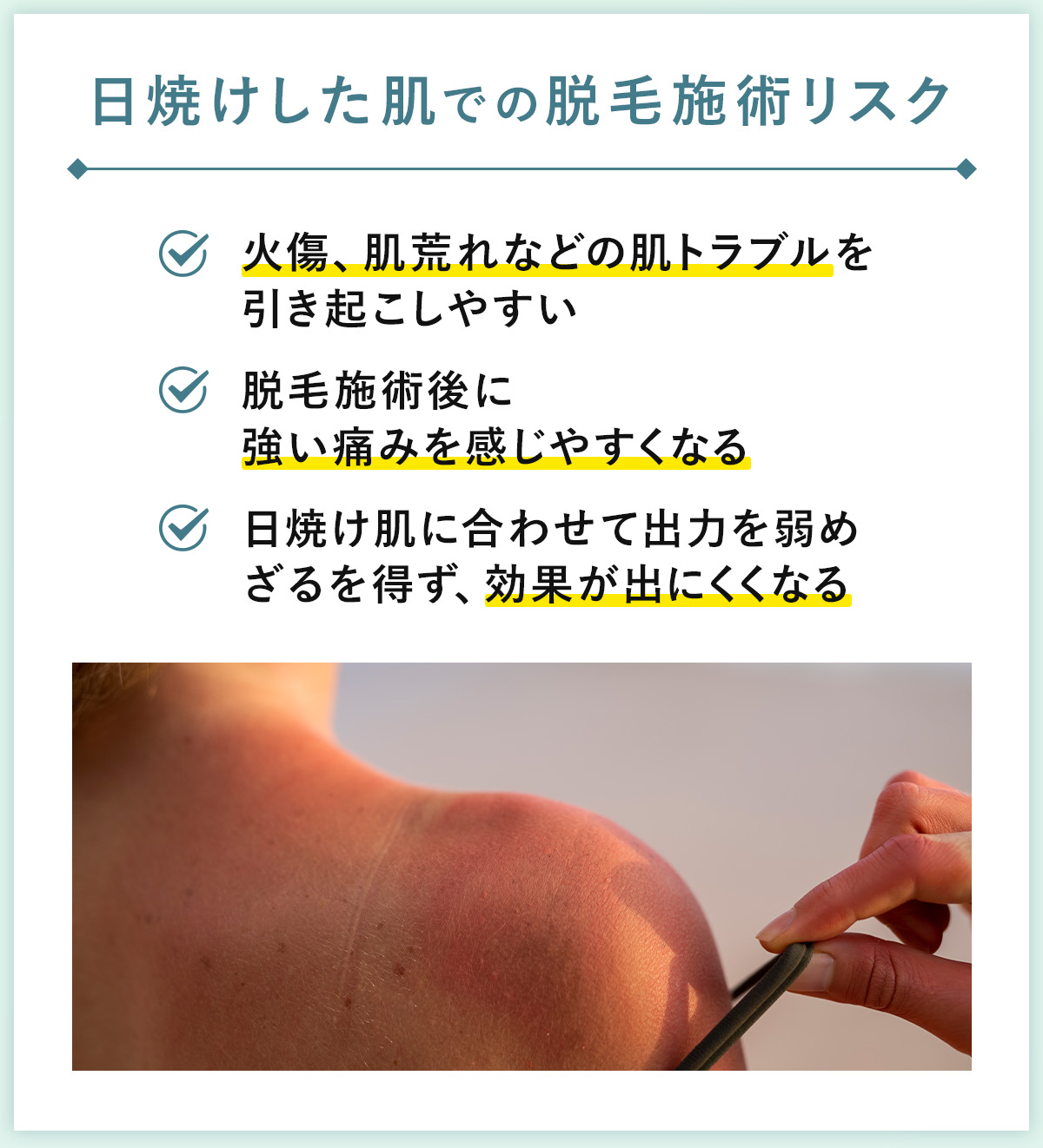 01_日焼けした肌でも脱毛施術リスク