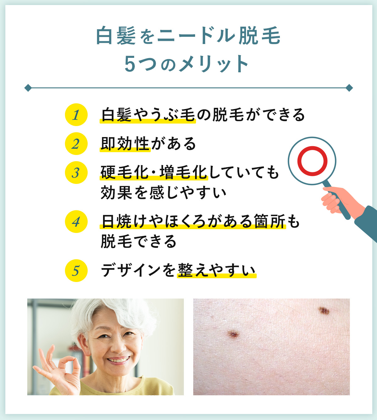 03_白髪をニードル脱毛5つのメリット