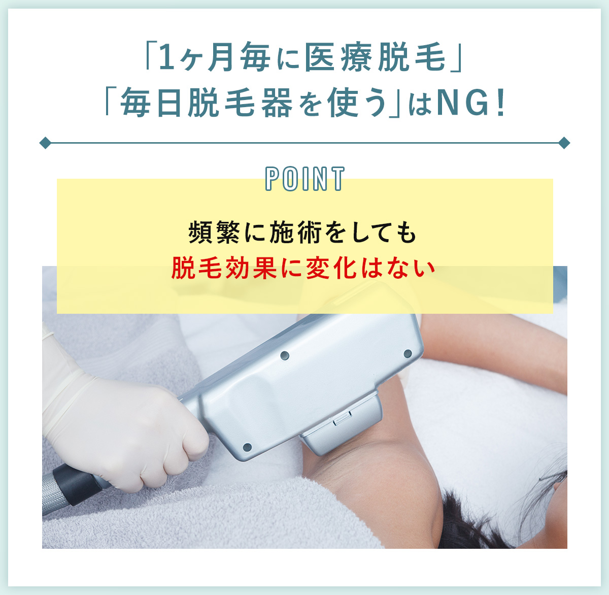 03_「1ヶ月毎に医療脱毛」「毎日脱毛器を使う」はNG!