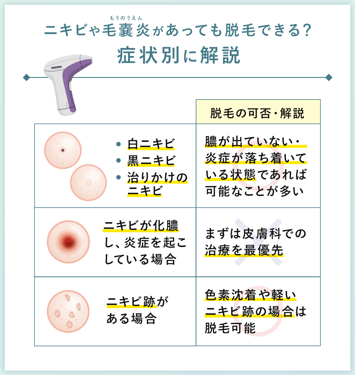 04_ニキビや毛嚢炎があっても脱毛できる?症状別に解説