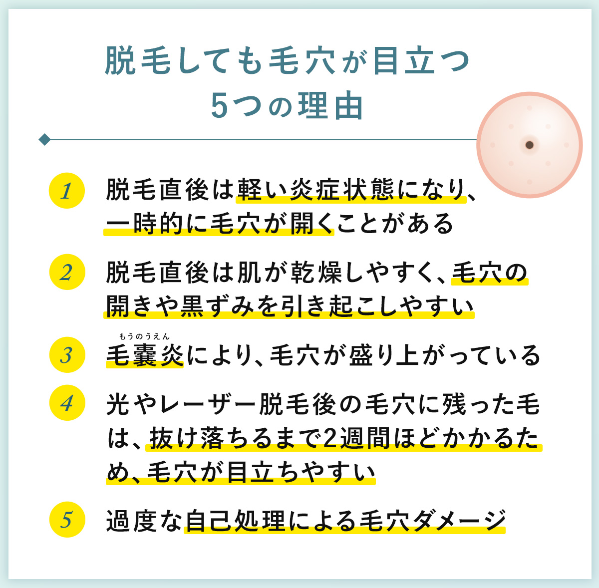 05_脱毛しても毛穴が目立つ5つの理由