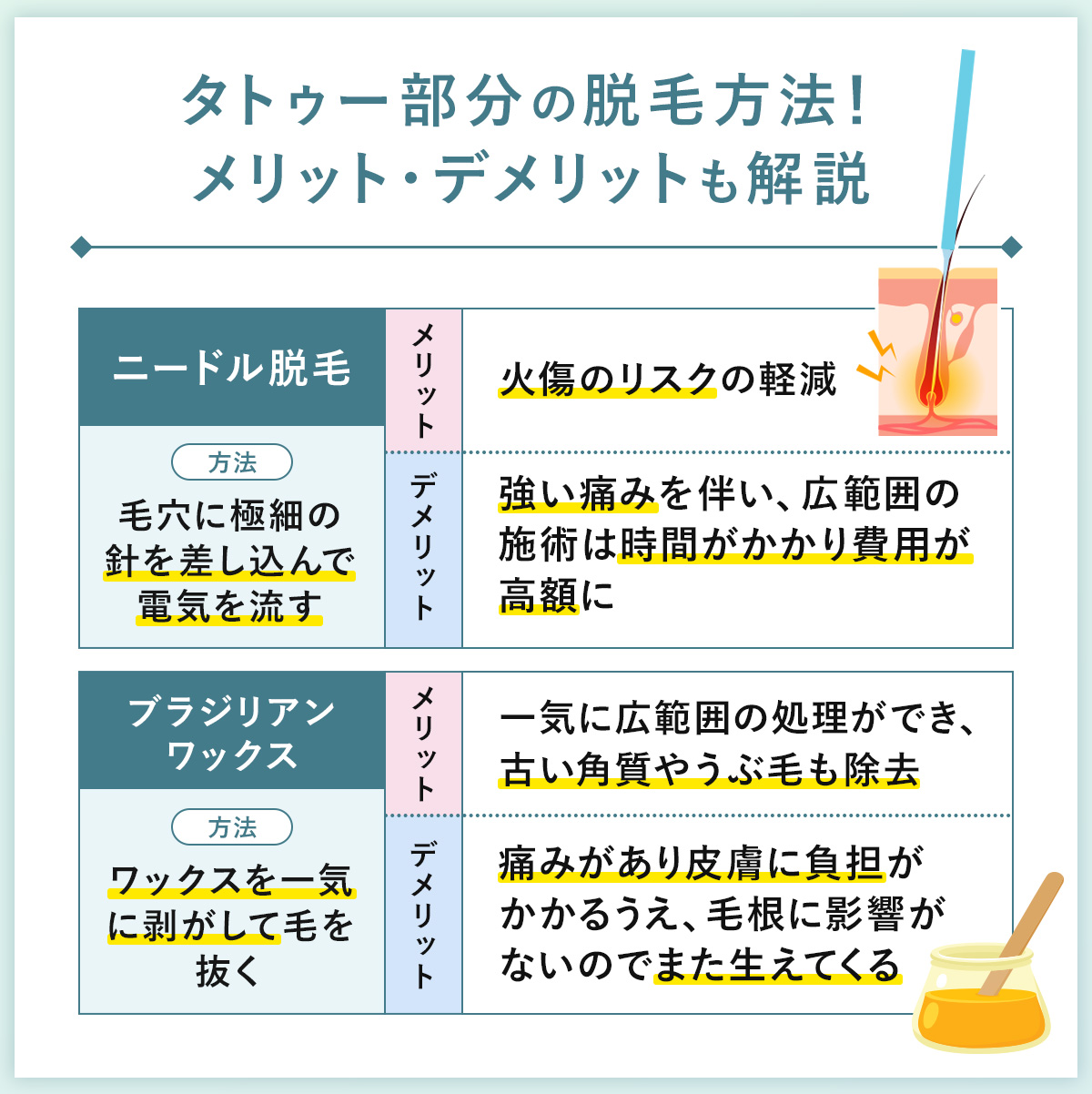 02_タトゥー部分の脱毛方法!メリット・デメリットも解説