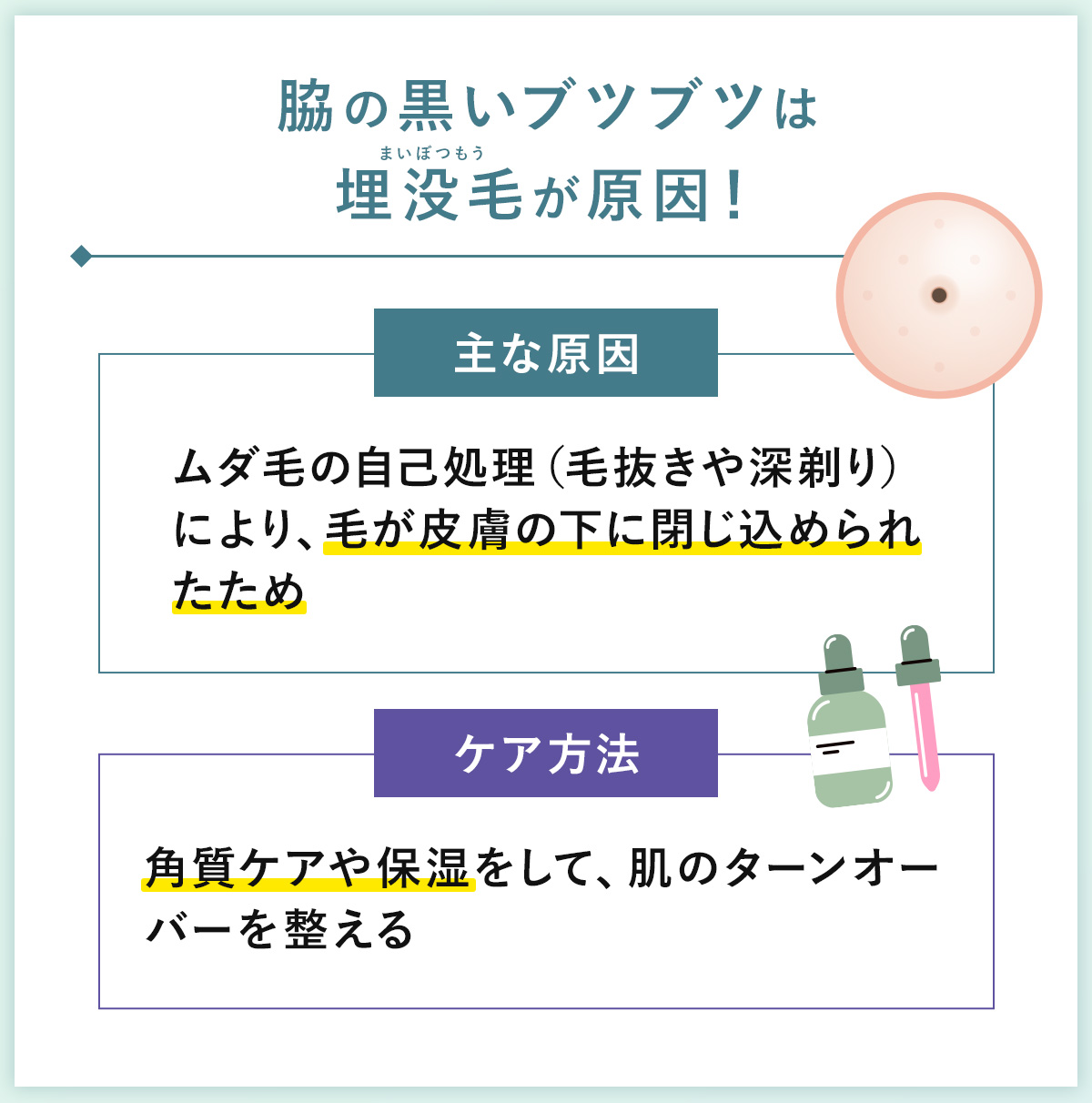 02_脇の黒いブツブツは埋没毛が原因!