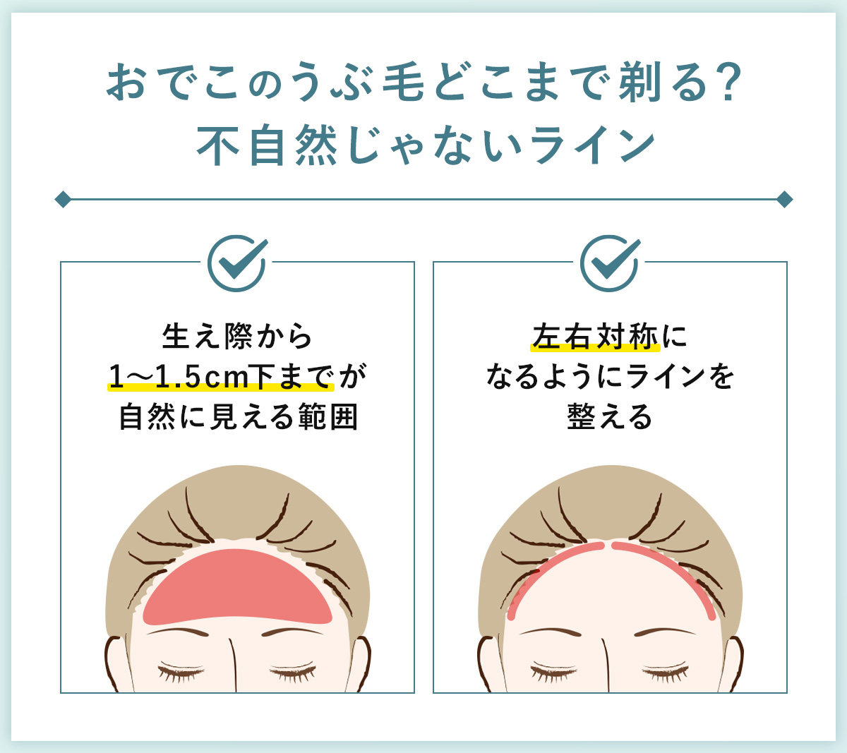 03_おでこのうぶ毛どこまで剃る?不自然じゃないライン