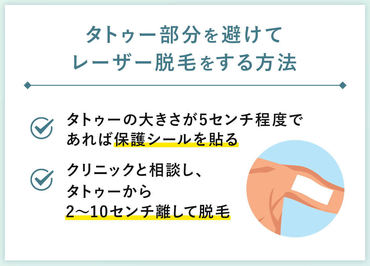 03_タトゥー部分を避けてレーザー脱毛をする方法