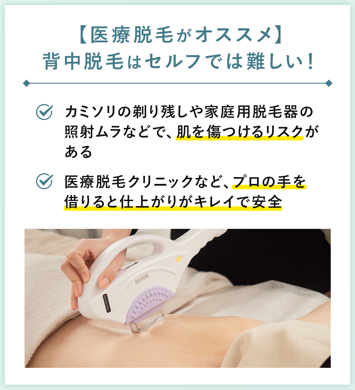 04_【医療脱毛がオススメ】背中脱毛はセルフでは難しい！