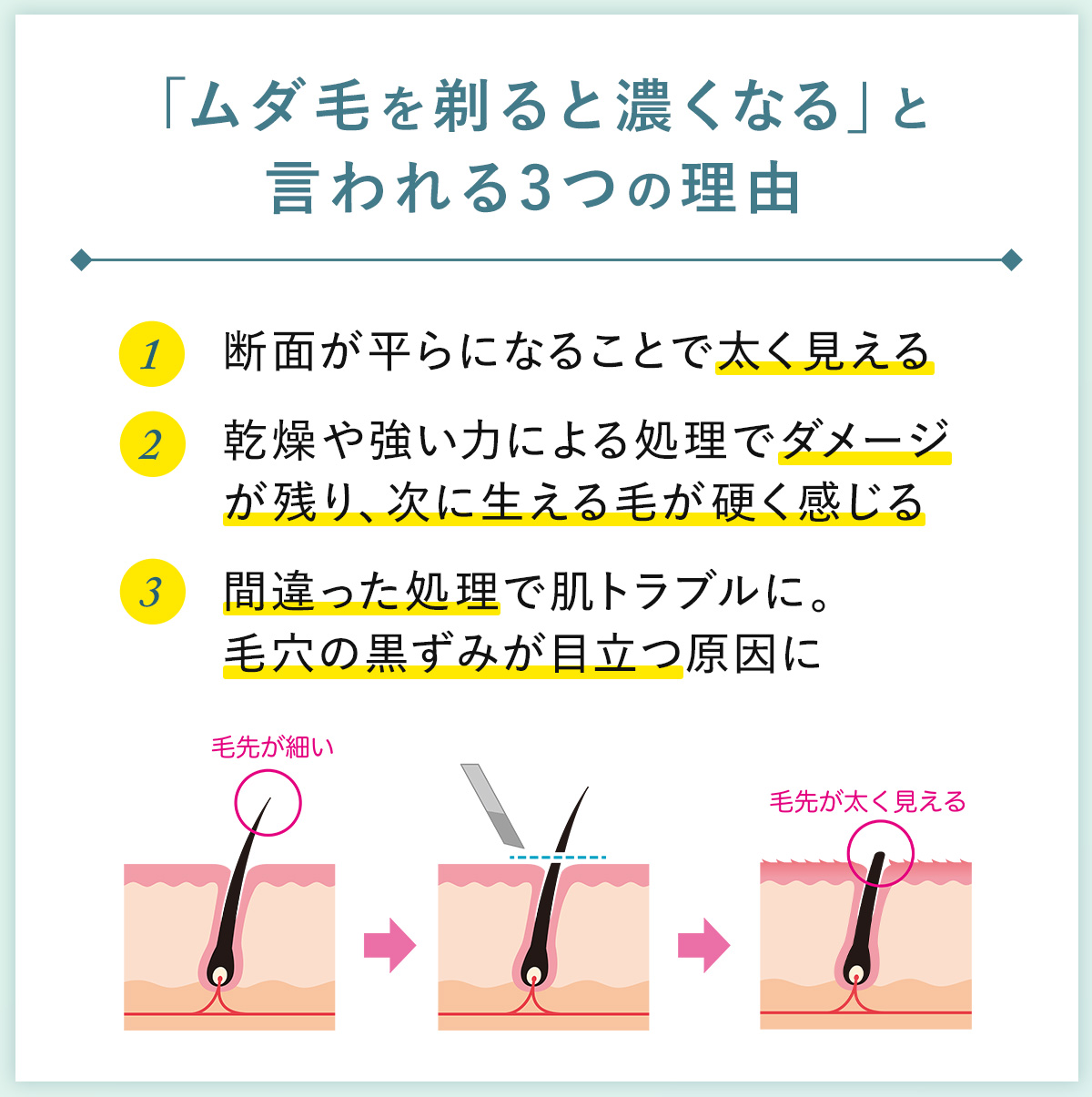 02_「ムダ毛を剃ると濃くなる」と言われる3つの理由