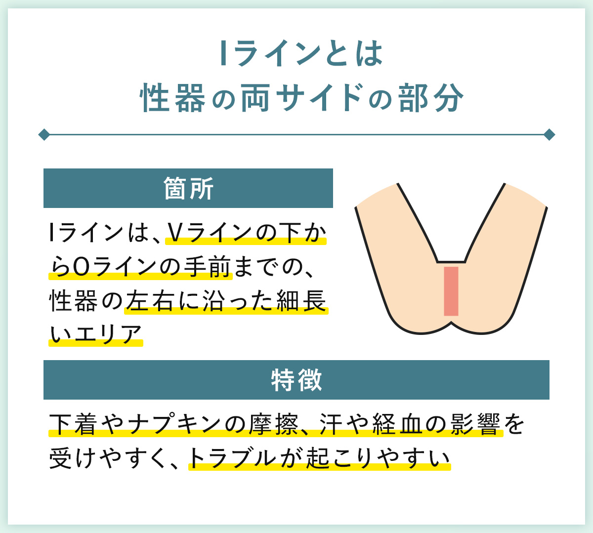 01_Iラインとは性器の両サイドの部分