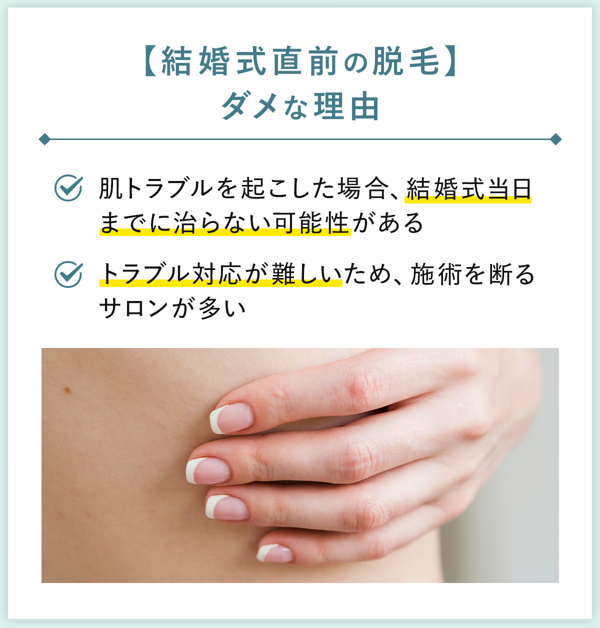 03_【結婚式直前の脱毛】ダメな理由