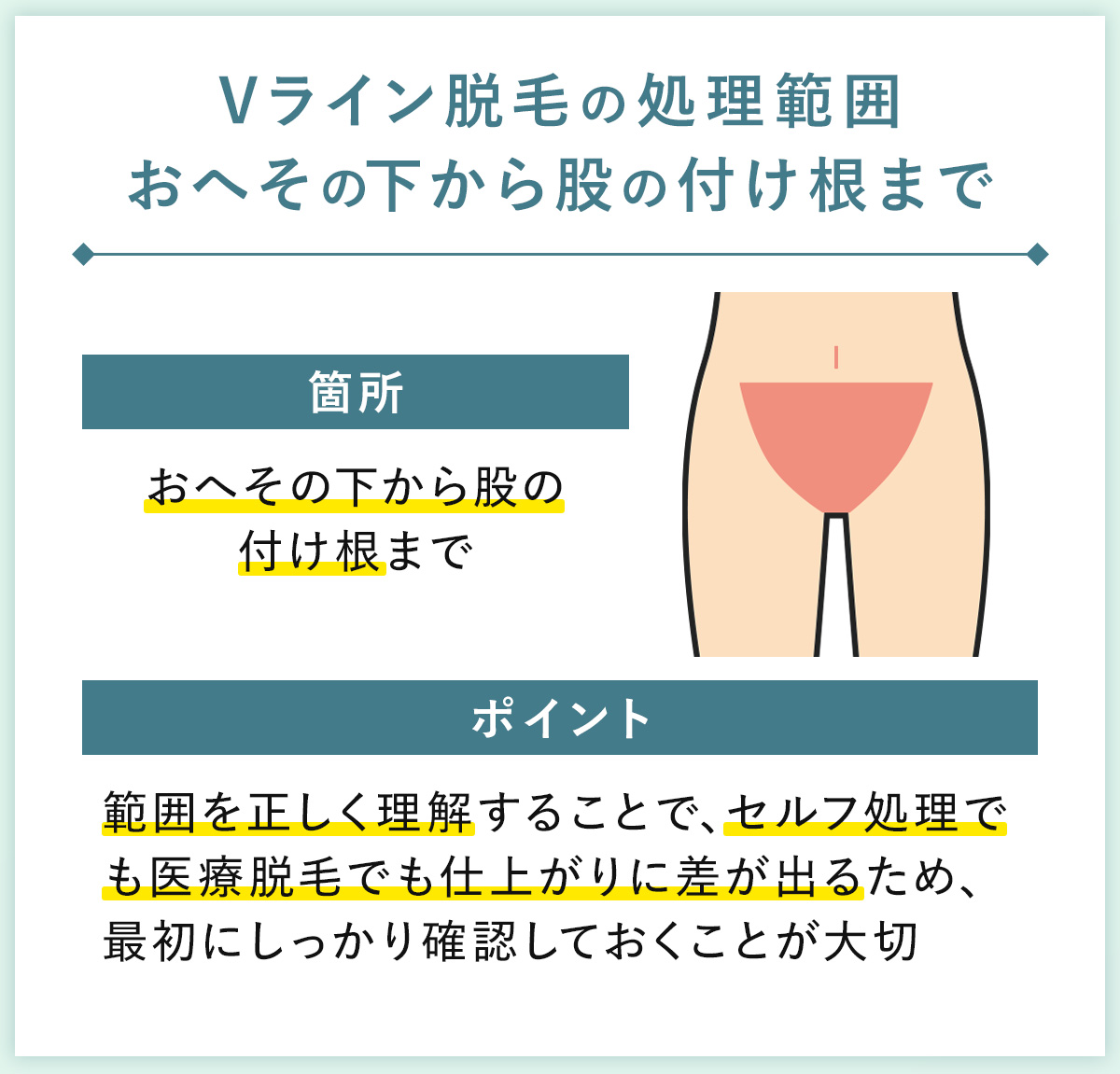01_Vライン脱毛の処理範囲おへその下から股の付け根まで