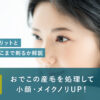 84_おでこ_うぶ毛