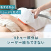 85_タトゥー_脱毛
