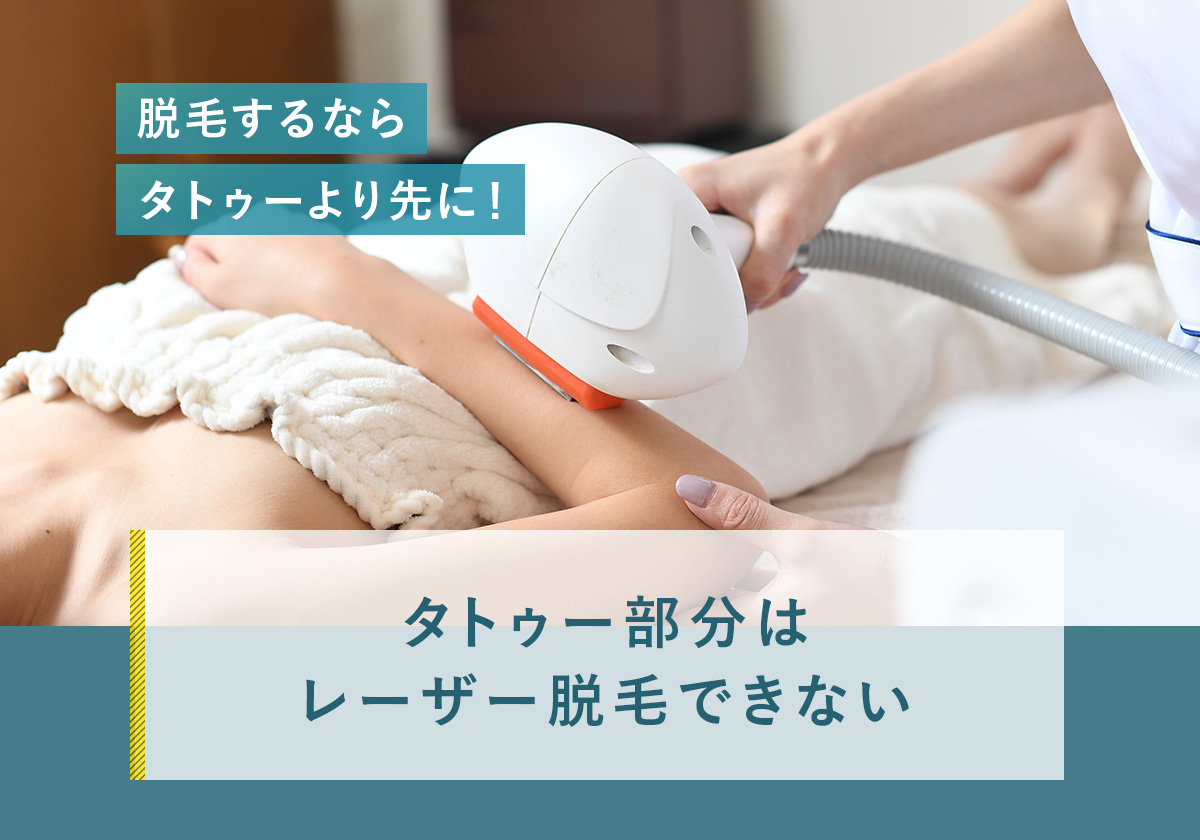 85_タトゥー_脱毛