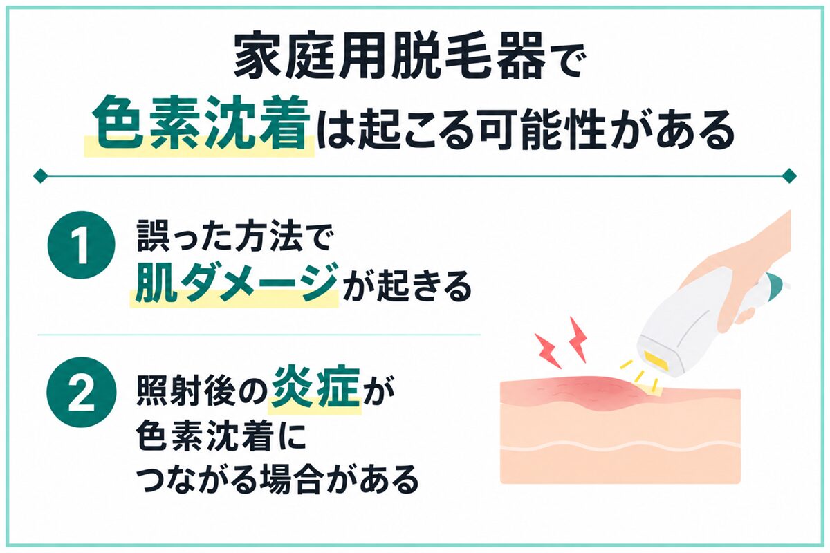 家庭用脱毛器で色素沈着は起こる可能性がある