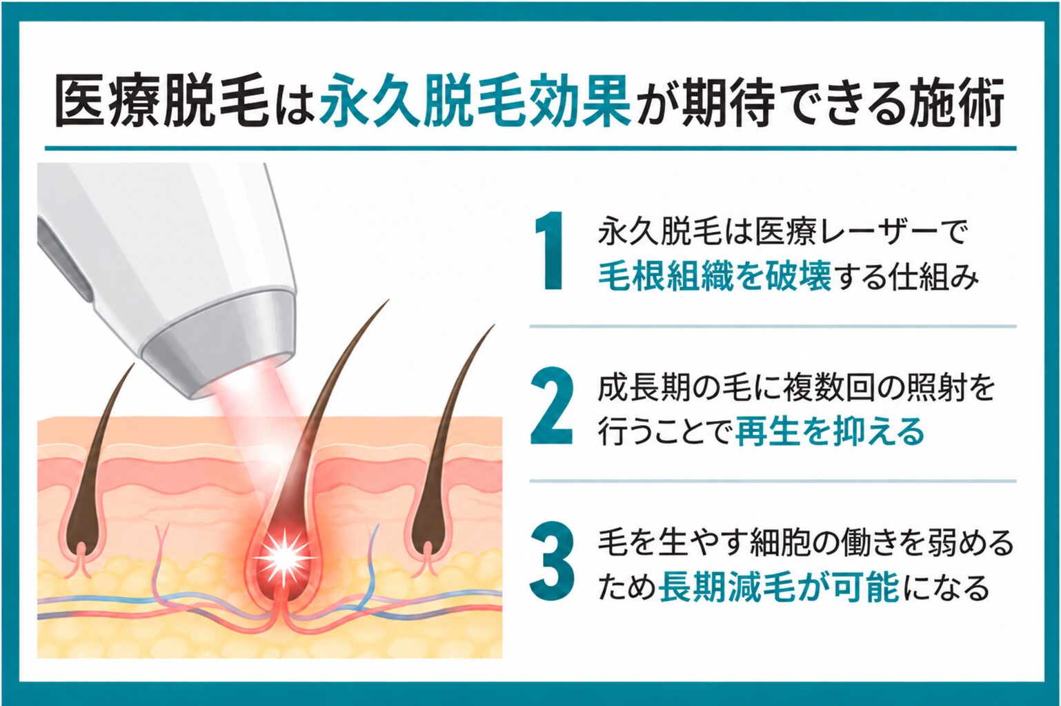 医療脱毛は永久脱毛効果が期待できる施術