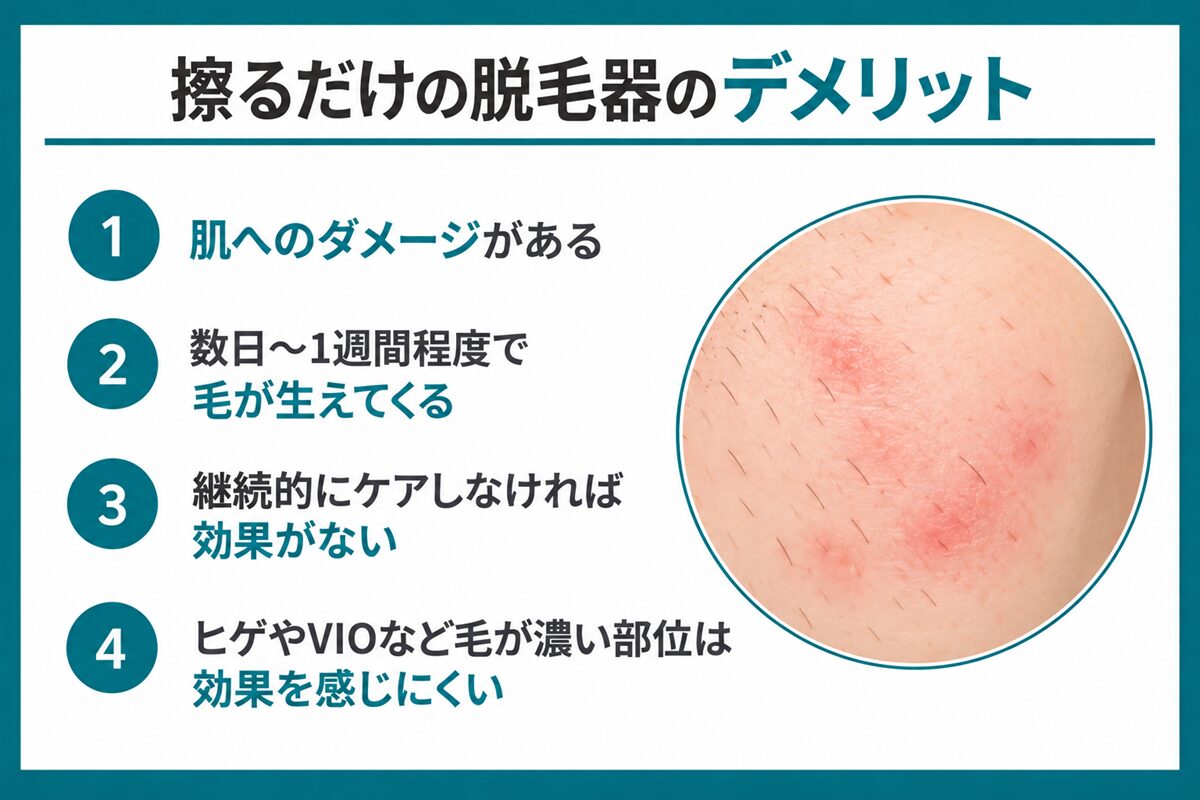 擦るだけの脱毛器のデメリット